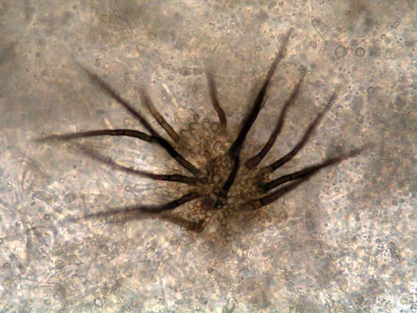 Acervulus pod mikroskopem