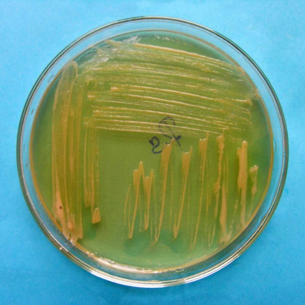 Kolonie bakterie Ralstolnia solanacearum