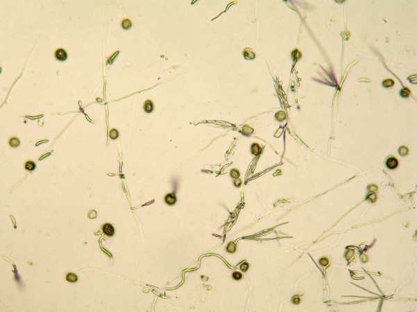 Při klíčení teliospor snětí mazlavých dochází k tvorbě promycelií a primárních i sekundárních sporidií Při klíčení teliospor snětí mazlavých dochází k tvorbě promycelií a primárních i sekundárních sporidií