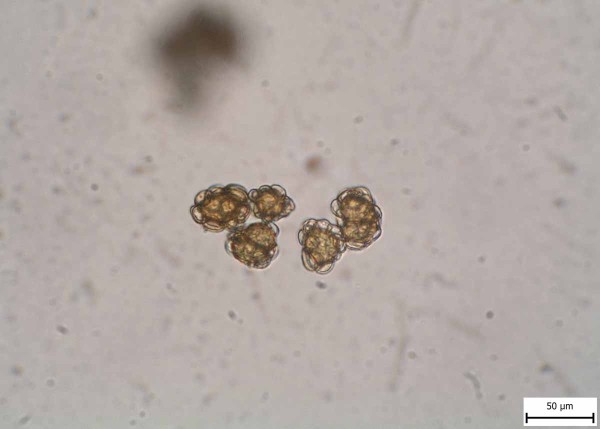 Urocystis occulta - chlamydospory