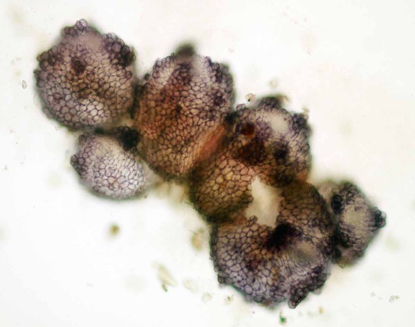 Obr. 3: Shluk několika perithecií (Fusarium spp.) na posklizňových zbytcích kukuřice v porostu jarního ječmene; perithecia jsou již vyprázdněna Obr. 3: Shluk několika perithecií (Fusarium spp.) na posklizňových zbytcích kukuřice v porostu jarního ječmene; perithecia jsou již vyprázdněna