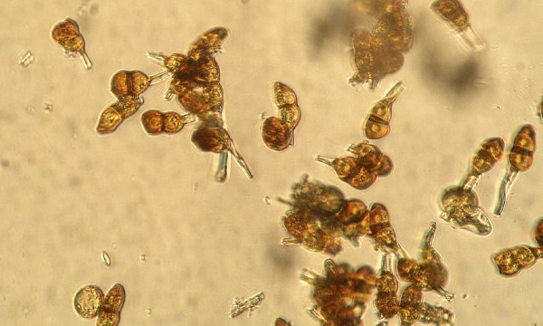 Puccinia sorghi - uredospora a teliospory Puccinia sorghi - uredospora a teliospory