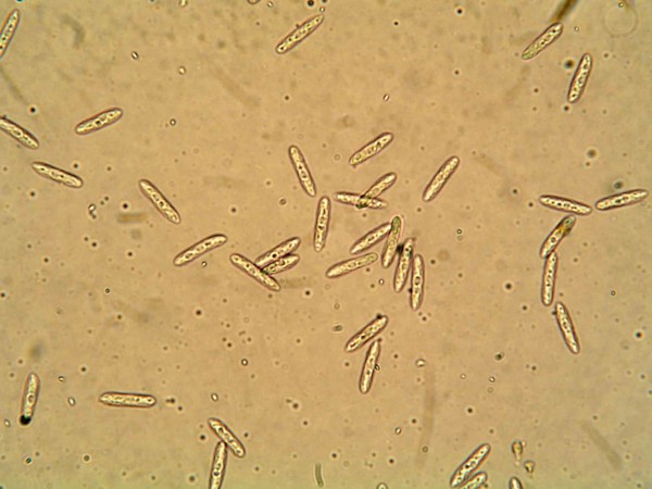 Konidie Colletotrichum coccodes
