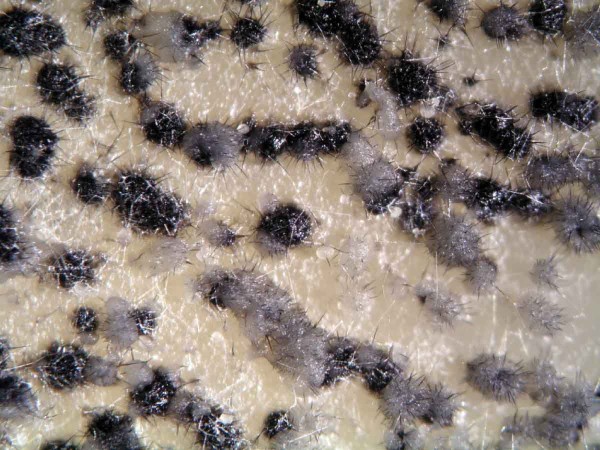 Acervuli na&nbsp;mediu