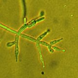 Využit&iacute; biologick&eacute; ochrany rostlin v&nbsp;syst&eacute;mu ekologick&eacute;ho pěstov&aacute;n&iacute; plodin