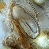 Háďátko řepné - biologie a možnosti ochrany Háďátko řepné - biologie a možnosti ochrany