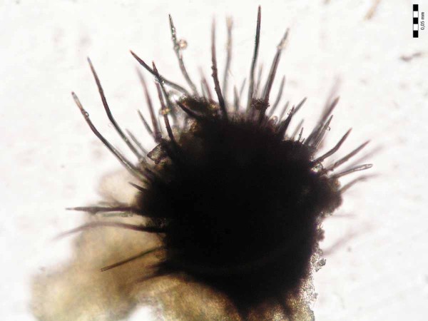 Acervulus pod mikroskopem