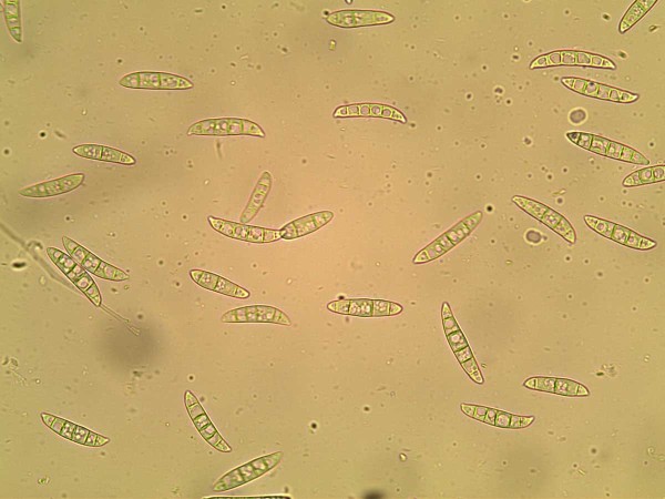 obr. 10 Makrokonidie