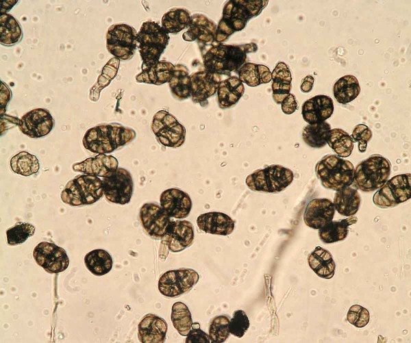 Konidie Alternaria alternata