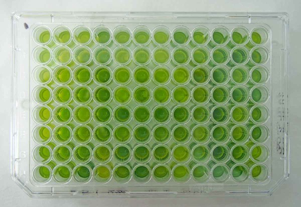 Elisa test na viry (č&iacute;m tmav&scaron;&iacute; zabarven&iacute; t&iacute;m vy&scaron;&scaron;&iacute; obsah viru)