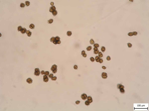 Urocystis occulta - chlamydospory