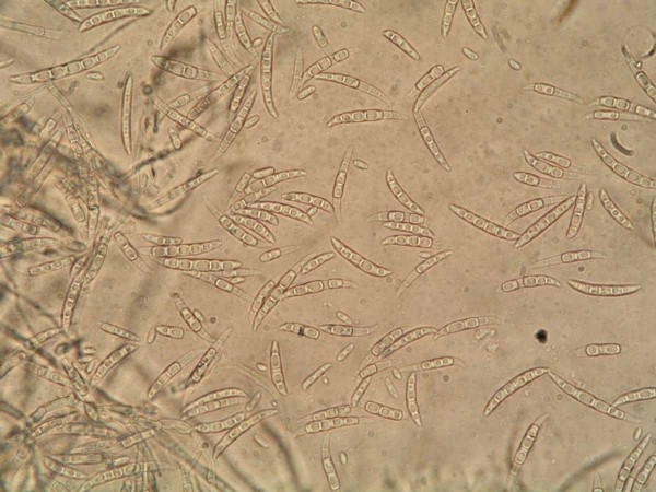 obr. 11 Makrokonidie