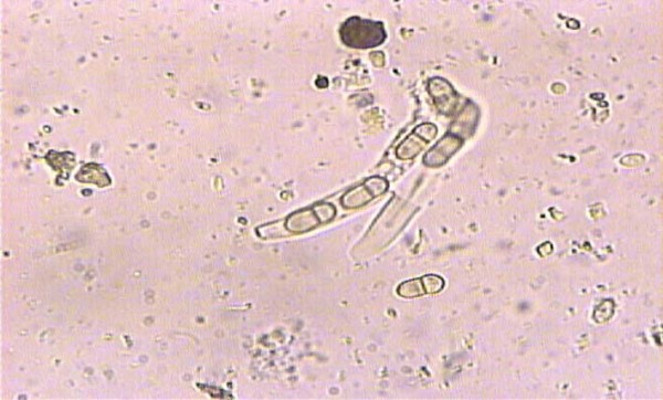 Obr. 5: Samovoln&eacute; uvolňov&aacute;n&iacute; askospor z&nbsp;vřecek