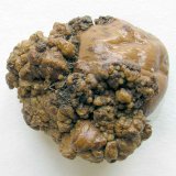 Choroby bramboru 8: Houbov&eacute; choroby bramboru (III.)