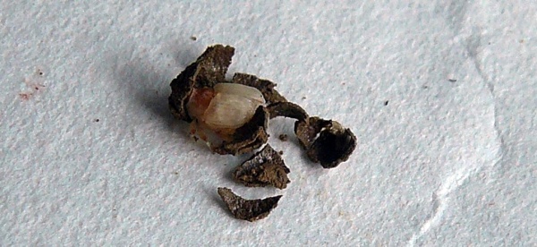 Vyv&iacute;jej&iacute;c&iacute; se jedinec v&nbsp;hliněn&eacute;m kokonu 