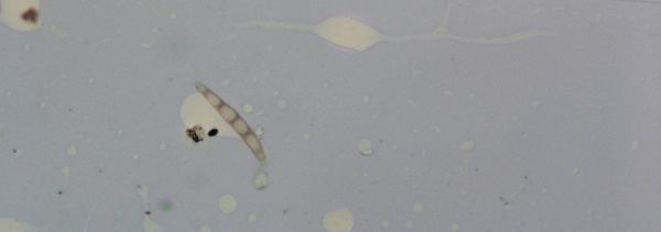 Askospora Leptosphaeria maculans nebo Leptosphaeria biglobosa (&copy; Ing. Jana Poslu&scaron;n&aacute;)