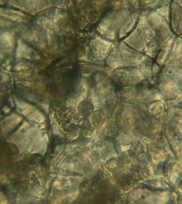 Sporangia obsahuj&iacute;c&iacute; letn&iacute; v&yacute;trusy patogena uvnitř buňky napaden&eacute;ho koř&iacute;nku